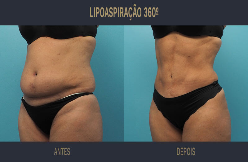 5 dicas sobre como melhorar sua recuperação